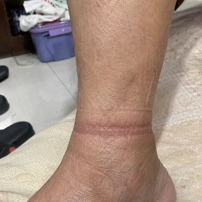 脚踝上的袜口印子