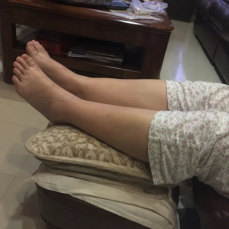 把脚放在枕头上抬高